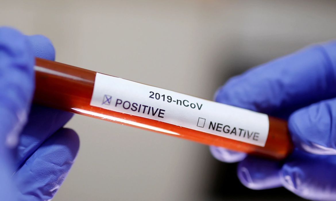 Camaçari inicia teste rápido para detectar coronavírus