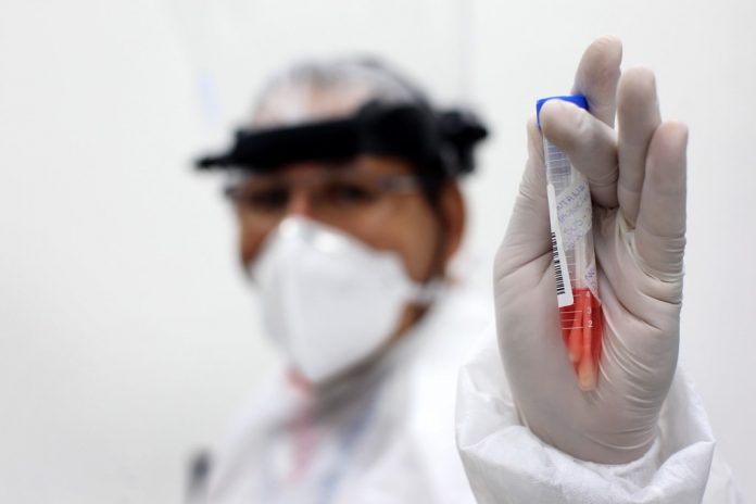Brasil registra mais de 220 mil mortes por coronavírus