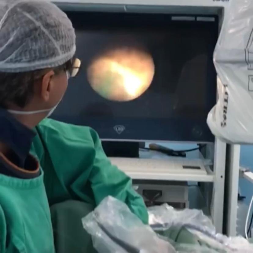 Martagão realiza primeira cirurgia de cálculo renal por laser do hospital
