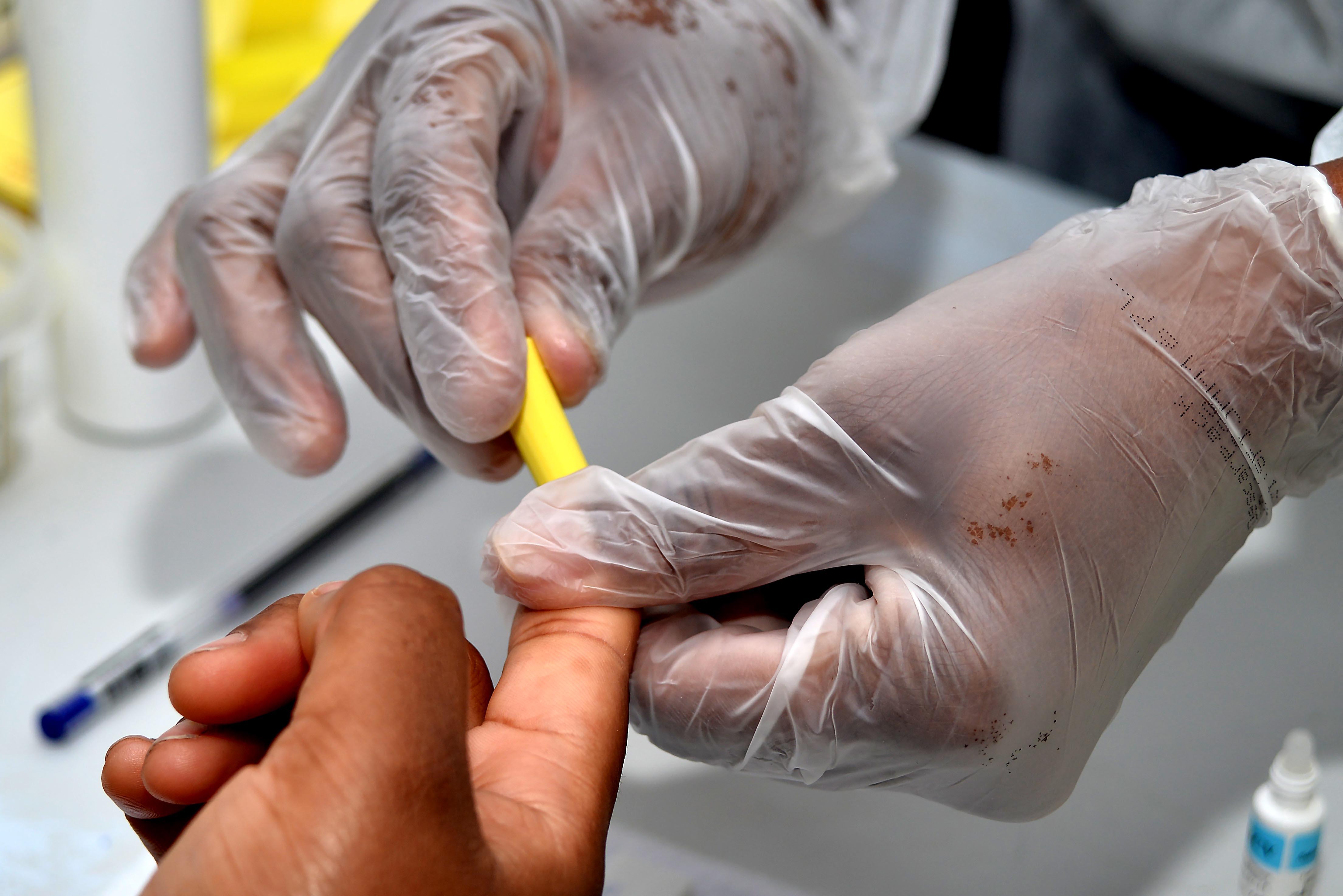 Julho Amarelo: Salvador intensifica prevenção às hepatites virais