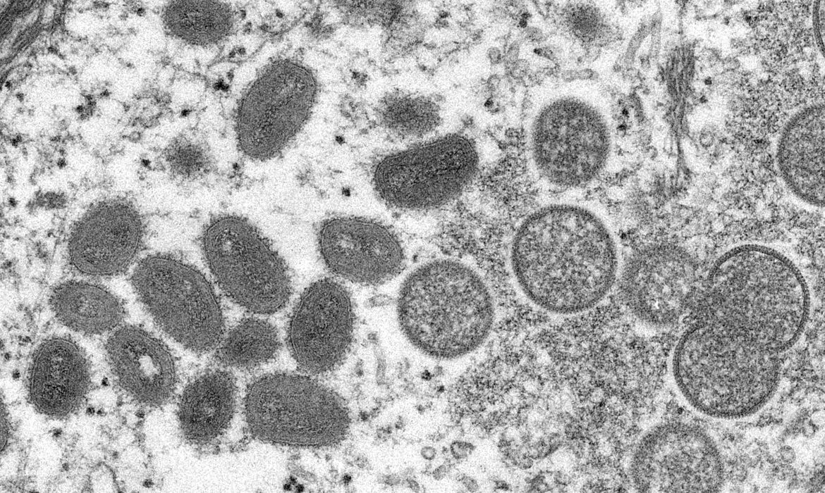 Brasil tem 250 casos da varíola dos macacos