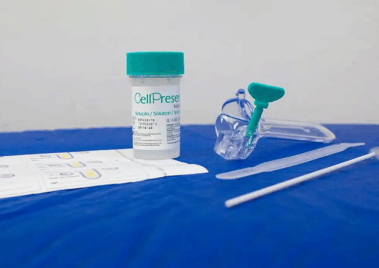 Novo teste do SUS detecta câncer do colo do útero