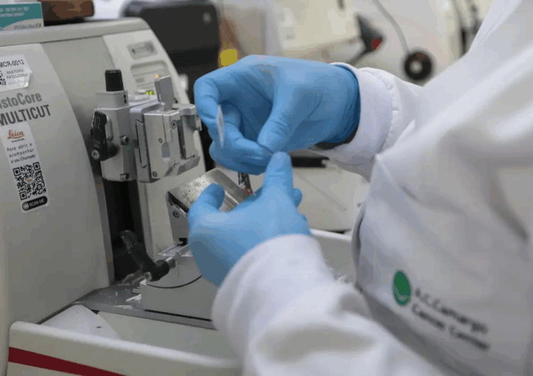 Cura de câncer de próstata pode chegar a até 98%