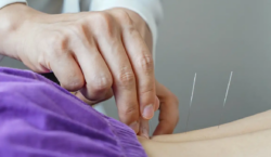 Brasil regulamenta exercício profissional da acupuntura