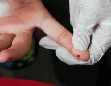 Teste rápido de dengue passa a integrar tabela do SUS