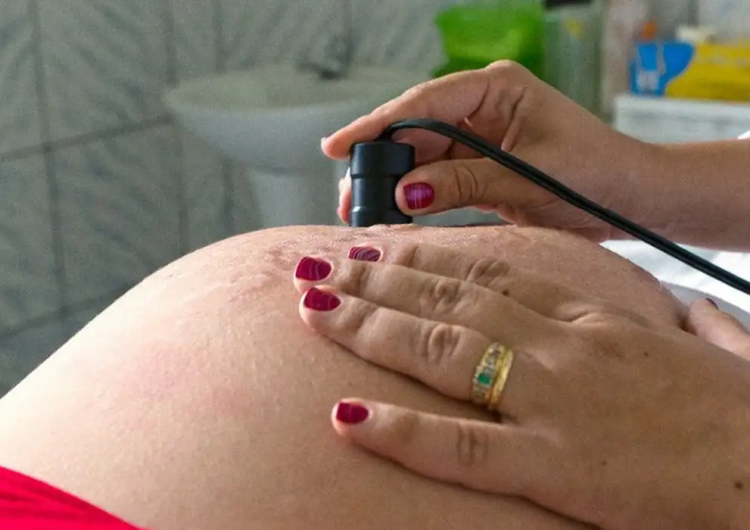 Risco de morte materna cai até 31% entre quem recebe o Bolsa Família